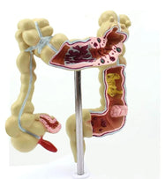 Human intestine and colon anatomy model showing internal anatomical structure