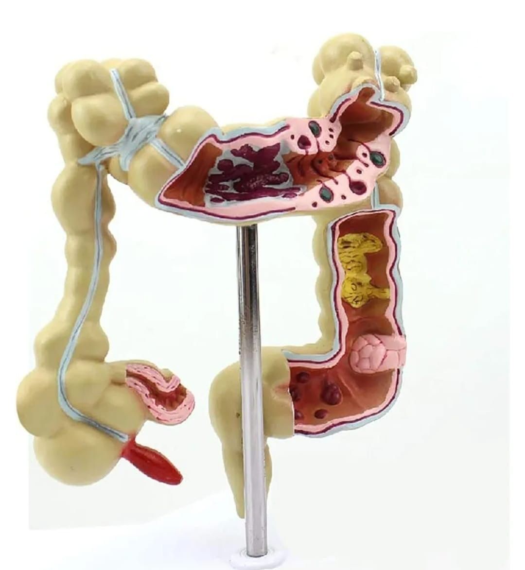 Human intestine and colon anatomy model showing internal anatomical structure