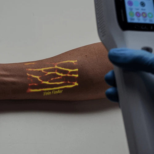 Infrared vein finder projecting vein image onto patient arm