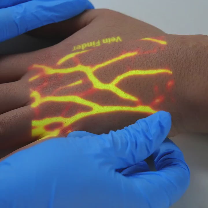 video of vein viewer projecting vein image  onto patient hand